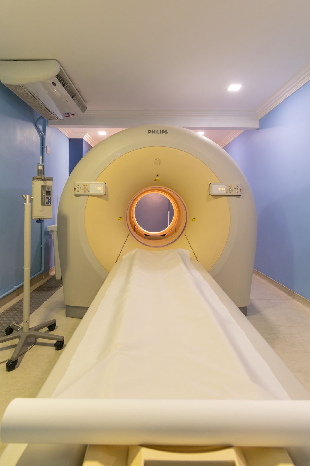 PET -CT BETA amiloide